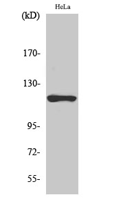 Fig.2. Western Blot analysis of hela cells using HXK I Polyclonal Antibody diluted at 1:1000.