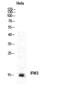 Fig.1. Western Blot analysis of various cells using IFITM3 Polyclonal Antibody diluted at 1:2000.
