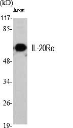 Fig.1. Western Blot analysis of various cells using IL-20Rα Polyclonal Antibody.