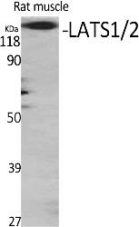 Fig. Western Blot analysis of various cells using LATS1/2 Polyclonal Antibody diluted at 1:500.