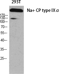 Fig. Western Blot analysis of various cells using Na+ CP type IXα Polyclonal Antibody diluted at 1:1000.