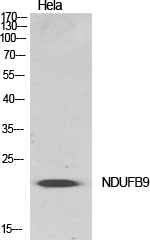 Fig.1. Western Blot analysis of various cells using NDUFB9 Polyclonal Antibody diluted at 1:500.