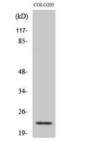 Fig.2. Western Blot analysis of 293 cells using NDUFB9 Polyclonal Antibody diluted at 1:500.
