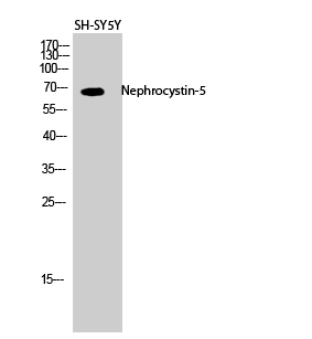 Fig.2. Western Blot analysis of SH-SY5Y cells using Nephrocystin-5 Polyclonal Antibody diluted at 1:500.