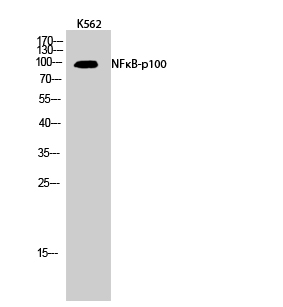 Fig.2. Western Blot analysis of K562 cells using NFκB-p100 Polyclonal Antibody diluted at 1:1000.