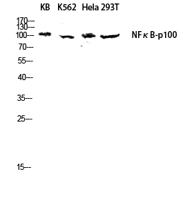 Fig.3. Western blot analysis of KB, K562,  hela and 293T lysates using NFκB-p100 antibody. Antibody was diluted at 1:1000.