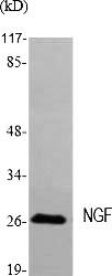 Fig.1. Western Blot analysis of various cells using NGF Polyclonal Antibody diluted at 1:2000.