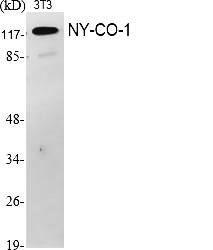 Fig.1. Western Blot analysis of various cells using NY-CO-1 Polyclonal Antibody.