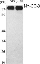 Fig.1. Western Blot analysis of various cells using NY-CO-9 Polyclonal Antibody.