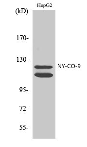 Fig.2. Western Blot analysis of HepG2 cells using NY-CO-9 Polyclonal Antibody.