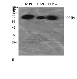 Fig.2. Western Blot analysis of A549, AD293, HepG2 using OATP1 Polyclonal Antibody. Antibody was diluted at 1:2000.