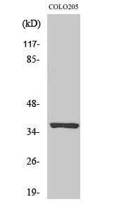 Fig. Western Blot analysis of various cells using Olfactory receptor 52E5 Polyclonal Antibody.
