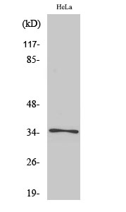 Fig. Western Blot analysis of various cells using Olfactory receptor 52E6 Polyclonal Antibody diluted at 1:1000.