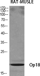 Fig.1. Western Blot analysis of various cells using Op18 Polyclonal Antibody diluted at 1:500.