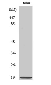 Fig.2. Western Blot analysis of Jurkat cells using Op18 Polyclonal Antibody diluted at 1:500.
