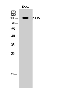 Fig.2. Western Blot analysis of K562 cells using p115 Polyclonal Antibody diluted at 1:2000.