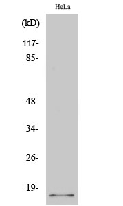 Fig. Western Blot analysis of various cells using p14 Polyclonal Antibody diluted at 1:500.