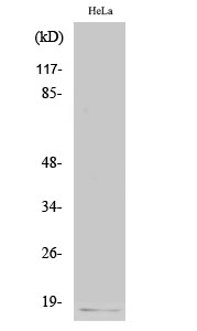 Fig. Western Blot analysis of various cells using p16 Polyclonal Antibody.