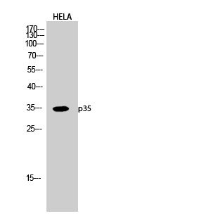 Fig.2. Western Blot analysis of hela cells using p35 Polyclonal Antibody diluted at 1:1000.