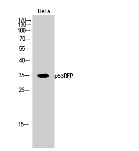 Fig.2. Western Blot analysis of hela cells using p53RFP Polyclonal Antibody.