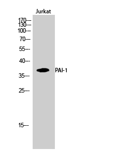 Fig.2. Western Blot analysis of Jurkat cells using PAI-1 Polyclonal Antibody.