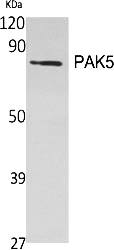 Fig.1. Western Blot analysis of various cells using PAK5 Polyclonal Antibody.