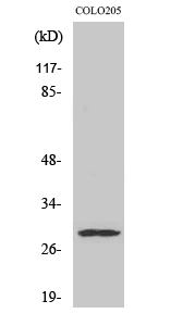 Fig. Western Blot analysis of various cells using Peroxin 11β Polyclonal Antibody diluted at 1:500.