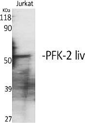 Fig.1. Western Blot analysis of various cells using PFK-2 liv Polyclonal Antibody.