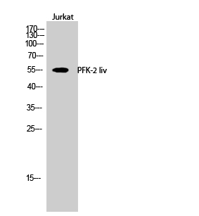 Fig.2. Western Blot analysis of Jurkat cells using PFK-2 liv Polyclonal Antibody.