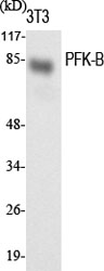 Fig.1. Western Blot analysis of various cells using PFK-B Polyclonal Antibody diluted at 1:1000.