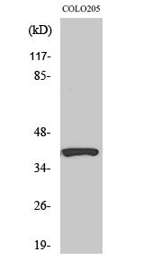 Fig. Western Blot analysis of various cells using PI-9 Polyclonal Antibody diluted at 1:1000.