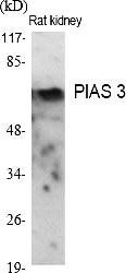 Fig.1. Western Blot analysis of various cells using PIAS 3 Polyclonal Antibody diluted at 1:2000.