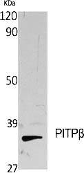 Fig.1. Western Blot analysis of various cells using PITPβ Polyclonal Antibody diluted at 1:2000.