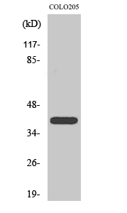 Fig.2. Western Blot analysis of COLO205 cells using PKA Iβ reg Polyclonal Antibody.