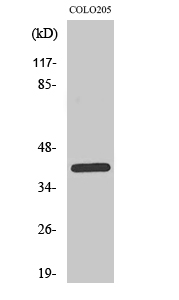 Fig.2. Western Blot analysis of COLO205 cells using PKAα/β/γ cat Polyclonal Antibody diluted at 1:1000.