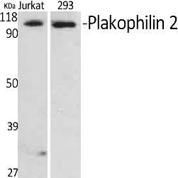 Fig.1. Western Blot analysis of various cells using Plakophilin 2 Polyclonal Antibody diluted at 1:500.