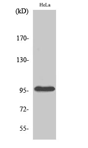 Fig.2. Western Blot analysis of HepG2 cells using Plakophilin 2 Polyclonal Antibody diluted at 1:500.