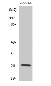 Fig. Western Blot analysis of various cells using PRSS33 Polyclonal Antibody.