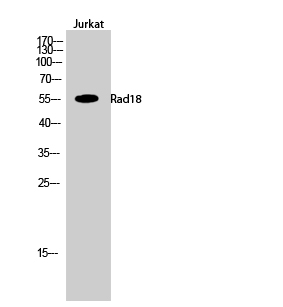 Fig.2. Western Blot analysis of Jurkat cells using Rad18 Polyclonal Antibody.