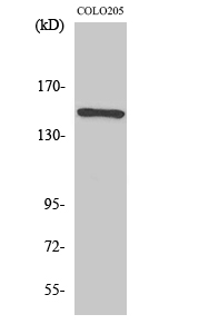 Fig. Western Blot analysis of various cells using Rad50 Polyclonal Antibody diluted at 1:1000.