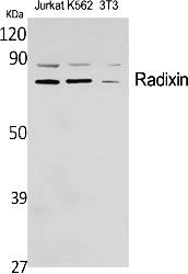 Fig.1. Western Blot analysis of various cells using Radixin Polyclonal Antibody diluted at 1:2000.