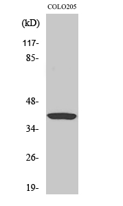 Fig.2. Western Blot analysis of hela cells using Ref-1 Polyclonal Antibody diluted at 1:2000.