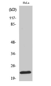 Fig. Western Blot analysis of various cells using Ribosomal Protein L18 Polyclonal Antibody diluted at 1:2000.