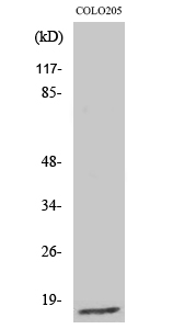 Fig. Western Blot analysis of various cells using Ribosomal Protein L27A Polyclonal Antibody diluted at 1:2000.