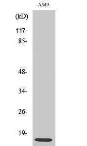 Fig. Western Blot analysis of various cells using Ribosomal Protein L30 Polyclonal Antibody diluted at 1:2000.