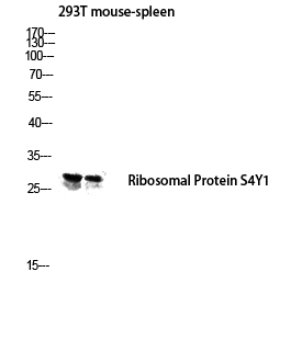 Fig.2. Western blot analysis of 293T, Mouse-spleen lysate using Ribosomal Protein S4Y1 antibody. Antibody was diluted at 1:1000.