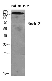 Fig. Western Blot analysis of various cells using Rock-2 Polyclonal Antibody diluted at 1:1000.