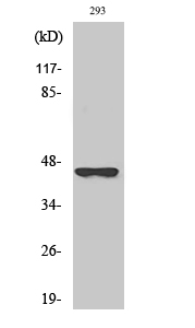 Fig. Western Blot analysis of various cells using SCCA2 Polyclonal Antibody.