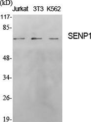 Fig. Western Blot analysis of various cells using SENP1 Polyclonal Antibody.