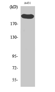 Fig.2. Western Blot analysis of A431 cells using Separase Polyclonal Antibody diluted at 1:1000.